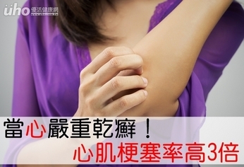 當「心」嚴重乾癬!心肌梗塞率高3倍
