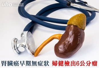 腎臟癌早期無症狀 婦健檢出6公分瘤