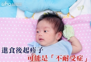 進食後起疹子 可能是「不耐受症」