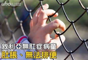 敘利亞無肛症病童 肚脹、無法排便