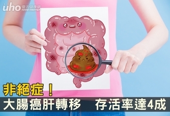 非絕症!大腸癌肝轉移 存活率達4成