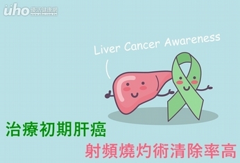 治療初期肝癌 射頻燒灼術清除率高