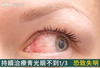 持續治療青光眼不到1/3 恐致失明