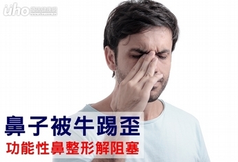 鼻子被牛踢歪 功能性鼻整形解阻塞