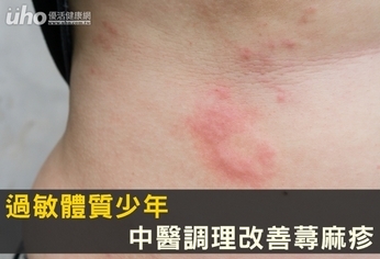 過敏體質少年 中醫調理改善蕁麻疹