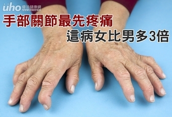 手部關節最先疼痛　這病女比男多3倍