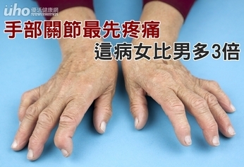 手部關節最先疼痛 這病女比男多3倍