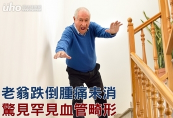 老翁跌倒腫痛未消 驚見罕見血管畸形
