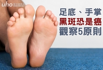 足底、手掌黑斑恐是癌!觀察5原則