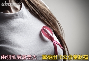 兩側乳房落差大 檢出10公分葉狀瘤