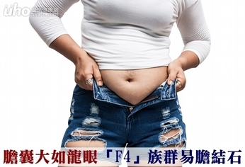 膽囊大如龍眼!「F4」族群易膽結石