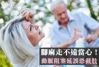 腳麻走不遠當心!動脈阻塞延誤恐截肢