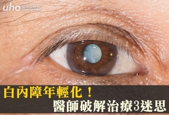 白內障年輕化!醫師破解治療3迷思