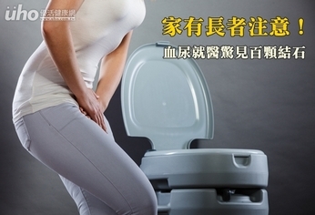 家有長者注意!血尿就醫驚見百顆結石