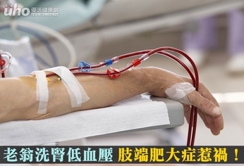 老翁洗腎低血壓 肢端肥大症惹禍!