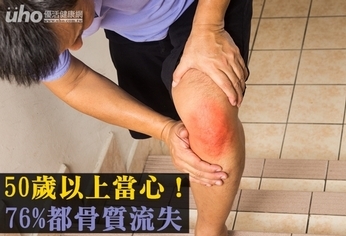 50歲以上當心!76%都骨質流失