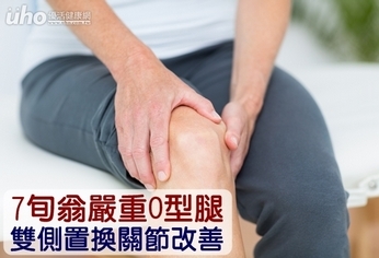 7旬翁嚴重O型腿　雙側置換關節改善