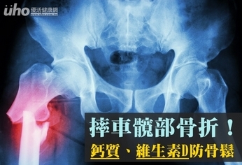 摔車髖部骨折!鈣質、維生素D防骨鬆