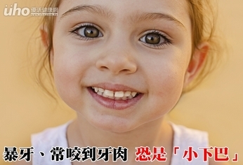 暴牙、常咬到牙肉 恐是「小下巴」