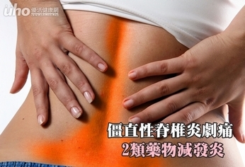 僵直性脊椎炎劇痛 2類藥物減發炎