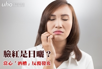 臉紅是日曬?當心「酒槽」反覆發炎