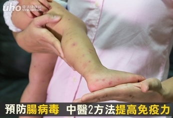 預防腸病毒 中醫2方法提高免疫力