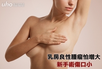 乳房良性腫瘤怕增大 新手術傷口小