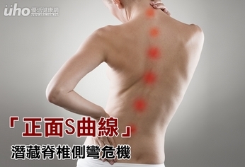 「正面S曲線」 潛藏脊椎側彎危機