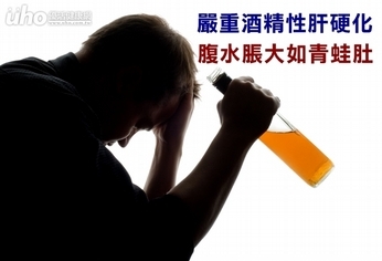 嚴重酒精性肝硬化 腹水脹大如青蛙肚