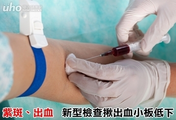 紫斑、出血 新型檢查揪出血小板低下