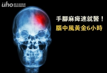 手腳麻痺速就醫!腦中風黃金6小時