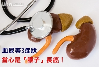 血尿等3症狀 當心是「腰子」長癌!