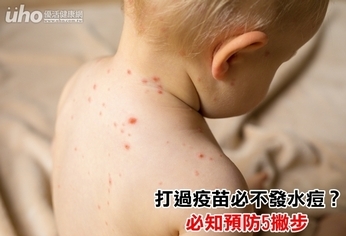 打過疫苗必不發水痘?須知預防5撇步