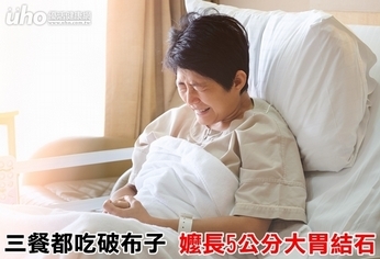 三餐都吃破布子 嬤長5公分大胃結石