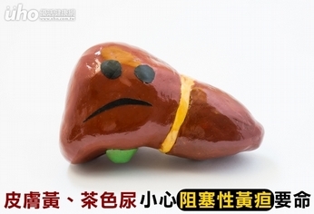 皮膚黃、茶色尿 小心阻塞性黃疸要命