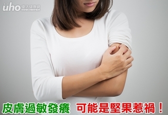 皮膚過敏發癢 可能是堅果惹禍!