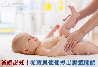 爸媽必知!從寶貝便便揪出膽道閉鎖