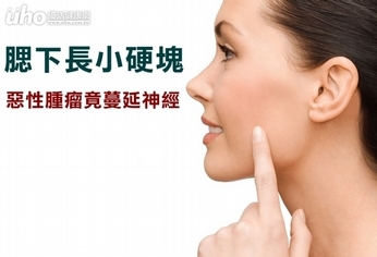 腮下長小硬塊 惡性腫瘤竟蔓延神經