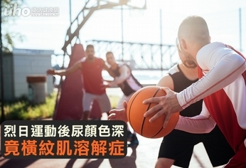 烈日運動後尿顏色深 竟橫紋肌溶解症