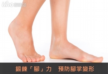 鍛鍊「腳」力 預防腳掌變形
