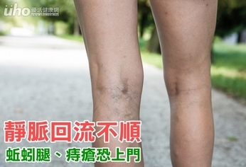 靜脈回流不順 蚯蚓腿、痔瘡恐上門