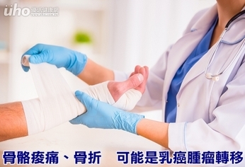 骨骼痠痛、骨折 可能是乳癌腫瘤轉移