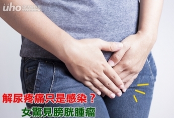 解尿疼痛只是感染？女驚見膀胱腫瘤