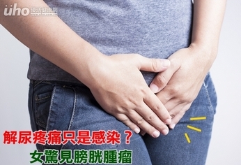 解尿疼痛只是感染?女驚見膀胱腫瘤