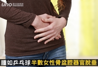 腫如乒乓球 半數女性骨盆腔器官脫垂