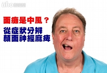 面癱是中風?從症狀分辨顏面神經麻痺