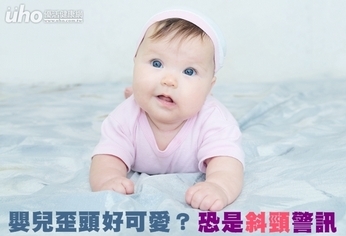 嬰兒歪頭好可愛?恐是「斜頸」警訊