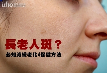 長老人斑?必知減緩老化4保健方法