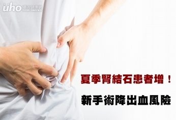 夏季腎結石患者增!新手術降出血風險