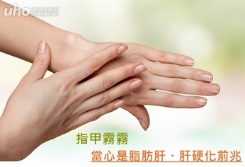 指甲霧霧 當心是脂肪肝、肝硬化前兆